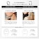 MYTREX　家庭用低周波治療器 DR. HEAT NECK マイトレックス ドクターヒートネック ホワイト MTDRHN21W